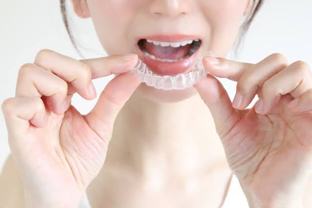 矯正歯科治療の種類
