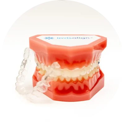 マウスピース矯正（インビザライン）・40代以降の矯正