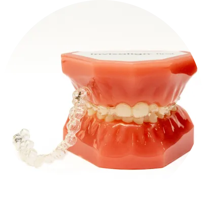 子どもの矯正　マウスピース矯正（インビザラインファースト）