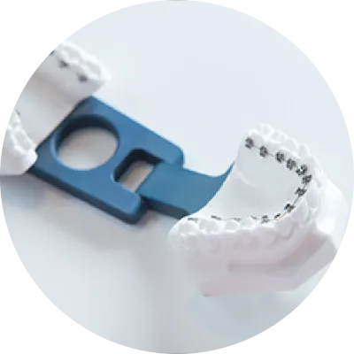 舌側・裏側ワイヤー矯正