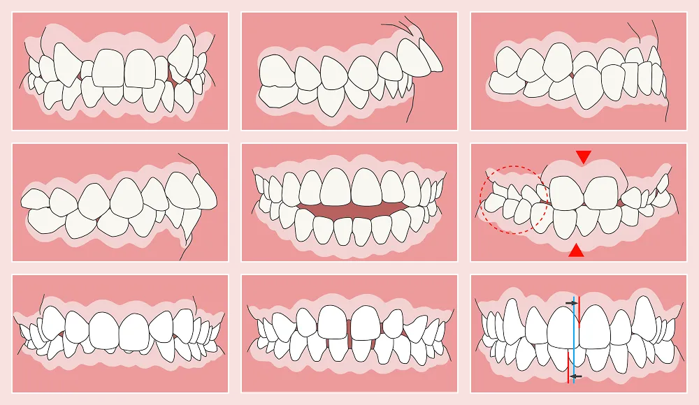 多種多様な矯正歯科治療の実績・症例数が多数